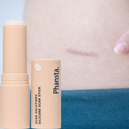 Phantsa Scar Solutions Silicone Scar Stick For Face & Body