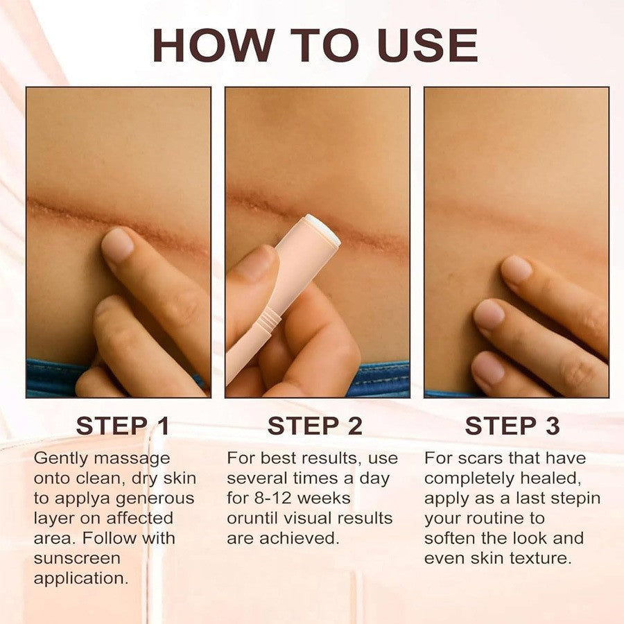Phantsa Scar Solutions Silicone Scar Stick For Face & Body