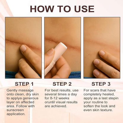 Phantsa Scar Solutions Silicone Scar Stick For Face & Body